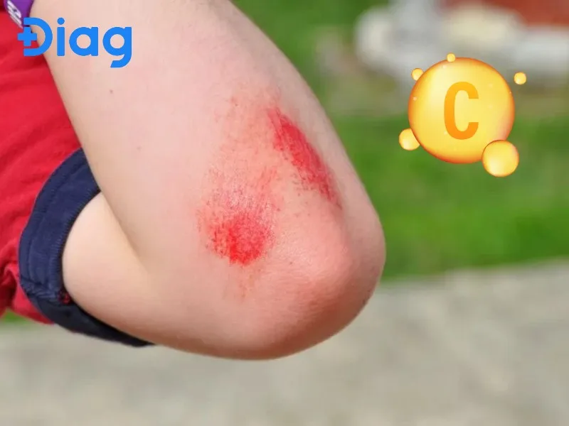 Vitamin C góp phần duy trì mô liên kết, mạch máu, răng nướu và quá trình phục hồi của cơ thể