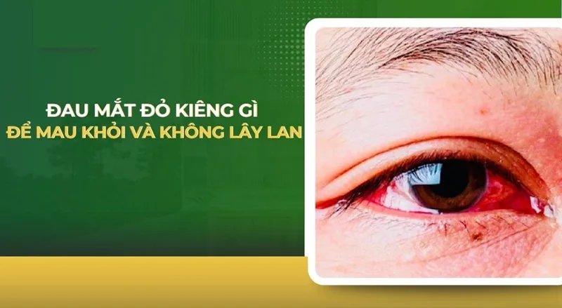 dau mat do kieng gi